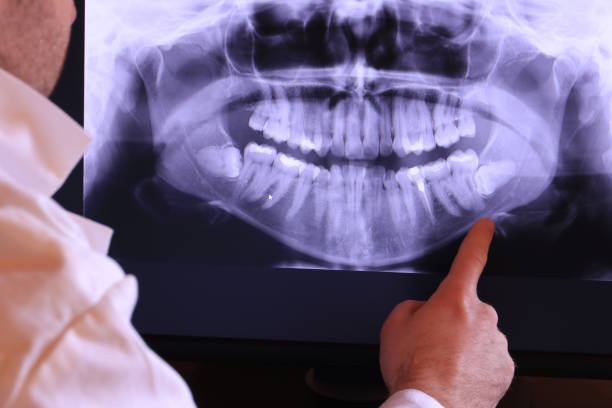 Best Emergency Tooth Extraction in Langley, SC
